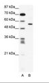 CBFA1 / RUNX2 Antibody - A: Marker, B: Jurkat Cell Lysate.  This image was taken for the unconjugated form of this product. Other forms have not been tested.