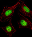 CBFA2T2 / MTGR1 Antibody - Fluorescent image of HeLa cell stained with CBFA2T2 Antibody. HeLa cells were fixed with 4% PFA (20 min), permeabilized with Triton X-100 (0.1%, 10 min), then incubated with CBFA2T2 primary antibody (1:25, 1 h at 37°C). For secondary antibody, Alexa Fluor 488 conjugated donkey anti-rabbit antibody (green) was used (1:400, 50 min at 37°C). Cytoplasmic actin was counterstained with Alexa Fluor 555 (red) conjugated Phalloidin (7units/ml, 1 h at 37°C). CBFA2T2 immunoreactivity is localized to Nucleus significantly.