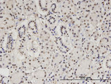 CBFA2T2 / MTGR1 Antibody - Immunoperoxidase of monoclonal antibody to CBFA2T2 on formalin-fixed paraffin-embedded human salivary gland. [antibody concentration 3 ug/ml]