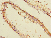CBFA2T2 / MTGR1 Antibody - Immunohistochemistry of paraffin-embedded human testis tissue at dilution 1:100