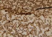 CBLB Antibody - 1:100 staining mouse brain tissue by IHC-P. The sample was formaldehyde fixed and a heat mediated antigen retrieval step in citrate buffer was performed. The sample was then blocked and incubated with the antibody for 1.5 hours at 22°C. An HRP conjugated goat anti-rabbit antibody was used as the secondary.