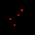 CBLC Antibody - Immunofluorescent analysis of Cbl-3 staining in A549 cells. Formalin-fixed cells were permeabilized with 0.1% Triton X-100 in TBS for 5-10 minutes and blocked with 3% BSA-PBS for 30 minutes at room temperature. Cells were probed with the primary antibody in 3% BSA-PBS and incubated overnight at 4 deg C in a humidified chamber. Cells were washed with PBST and incubated with a DyLight 594-conjugated secondary antibody (red) in PBS at room temperature in the dark.