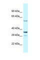CBLL1 / HAKAI Antibody - CBLL1 antibody Western blot of Mouse Kidney lysate. Antibody concentration 1 ug/ml.  This image was taken for the unconjugated form of this product. Other forms have not been tested.