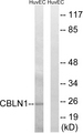 CBLN1 / Cerebellin 1 Antibody - Western blot analysis of lysates from HUVEC cells, using CBLN1 Antibody. The lane on the right is blocked with the synthesized peptide.
