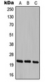 CBLN1 / Cerebellin 1 Antibody - Western blot analysis of Cerebellin 1 expression in HEK293T (A); SP2/0 (B); PC12 (C) whole cell lysates.