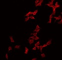 CBLN2 / Cerebellin 2 Antibody - Staining HeLa cells by IF/ICC. The samples were fixed with PFA and permeabilized in 0.1% Triton X-100, then blocked in 10% serum for 45 min at 25°C. The primary antibody was diluted at 1:200 and incubated with the sample for 1 hour at 37°C. An Alexa Fluor 594 conjugated goat anti-rabbit IgG (H+L) Ab, diluted at 1/600, was used as the secondary antibody.
