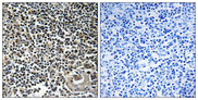 CBLN4 / Cerebellin 4 Antibody - Immunohistochemistry analysis of paraffin-embedded human thymus gland tissue, using CBLN4 Antibody. The picture on the right is blocked with the synthesized peptide.