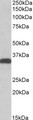 CBR3 Antibody - Goat Anti-CBR3 Antibody (0.5µg/ml) staining of HEK293 lysate (35µg protein in RIPA buffer). Primary incubation was 1 hour. Detected by chemiluminescencence.