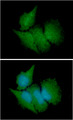 CBR3 Antibody - ICC/IF analysis of CBR3 in HeLa cells line, stained with DAPI (Blue) for nucleus staining and monoclonal anti-human CBR3 antibody (1:100) with goat anti-mouse IgG-Alexa fluor 488 conjugate (Green).
