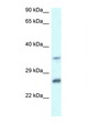 CBR4 Antibody - CBR4 antibody Western blot of Jurkat Cell lysate. Antibody concentration 1 ug/ml.  This image was taken for the unconjugated form of this product. Other forms have not been tested.