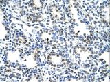 CBX3 / HP1 Gamma Antibody - CBX3 antibody ARP34721_T100-NP_057671-CBX3(chromobox homolog 3 (HP1 gamma homolog, Drosophila)) Antibody was used in IHC to stain formalin-fixed, paraffin-embedded human lung.  This image was taken for the unconjugated form of this product. Other forms have not been tested.