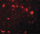 CBX4 Antibody - Immunofluorescence of CBX4 in human brain tissue with CBX4 antibody at 20 ug/ml.