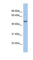 CBX8 Antibody - CBX8 antibody Western blot of COLO205 cell lysate. This image was taken for the unconjugated form of this product. Other forms have not been tested.