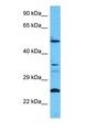 CC2D2B Antibody - Western blot of CC2D2B Antibody with human HT1080 Whole Cell lysate.  This image was taken for the unconjugated form of this product. Other forms have not been tested.