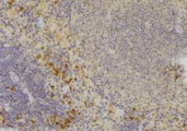 CCBE1 Antibody - 1:100 staining human lymph node tissue by IHC-P. The sample was formaldehyde fixed and a heat mediated antigen retrieval step in citrate buffer was performed. The sample was then blocked and incubated with the antibody for 1.5 hours at 22°C. An HRP conjugated goat anti-rabbit antibody was used as the secondary.