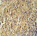 CCDC106 Antibody - CC106 Antibody immunohistochemistry of formalin-fixed and paraffin-embedded human spleen tissue followed by peroxidase-conjugated secondary antibody and DAB staining.