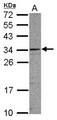 CCDC107 Antibody - Sample (30 ug of whole cell lysate) A: A549 12% SDS PAGE CCDC107 antibody diluted at 1:1000