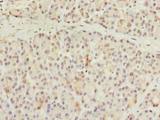 CCDC116 Antibody - Immunohistochemistry of paraffin-embedded human pancreatic tissue using antibody at dilution of 1:100.