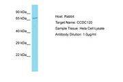 CCDC120 Antibody -  This image was taken for the unconjugated form of this product. Other forms have not been tested.