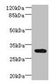 CCDC127 Antibody - Western blot All lanes: CCDC127 antibody at 6µg/ml + Mouse kidney tissue Secondary Goat polyclonal to rabbit IgG at 1/10000 dilution Predicted band size: 31 kDa Observed band size: 31 kDa