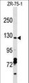 CCDC132 Antibody - CCDC132 Antibody western blot of ZR-75-1 cell line lysates (35 ug/lane). The CCDC132 antibody detected the CCDC132 protein (arrow).