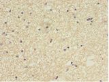 CCDC134 Antibody - Immunohistochemistry of paraffin-embedded human brain tissue using antibody at 1:100 dilution.  This image was taken for the unconjugated form of this product. Other forms have not been tested.
