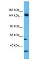 CCDC144A Antibody - CCDC144A antibody Western Blot of HeLa. Antibody dilution: 1 ug/ml.  This image was taken for the unconjugated form of this product. Other forms have not been tested.
