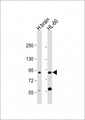 CCDC144A Antibody - All lanes: Anti-CCDC144A Antibody (C-Term) at 1:2000 dilution Lane 1: human brain lysate Lane 2: HL-60 whole cell lysate Lysates/proteins at 20 µg per lane. Secondary Goat Anti-Rabbit IgG, (H+L), Peroxidase conjugated at 1/10000 dilution. Predicted band size: 165 kDa Blocking/Dilution buffer: 5% NFDM/TBST.