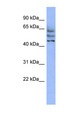 CCDC174 Antibody - C3orf19 antibody Western blot of HepG2 cell lysate. This image was taken for the unconjugated form of this product. Other forms have not been tested.