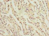 CCDC181 / C1orf114 Antibody - Immunohistochemistry of paraffin-embedded human lung tissue using antibody at dilution of 1:100.