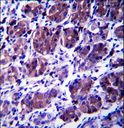 CCDC22 Antibody - CCDC22 Antibody immunohistochemistry of formalin-fixed and paraffin-embedded human stomach tissue followed by peroxidase-conjugated secondary antibody and DAB staining.