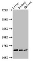 CCDC26 Antibody - Positive Western Blot detected in Rat liver tissue, Rat kidney tissue, Rat spleen tissue. All lanes: CCDC26 antibody at 2.6 µg/ml Secondary Goat polyclonal to rabbit IgG at 1/50000 dilution. Predicted band size: 14 KDa. Observed band size: 14 KDa