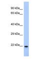CCDC27 Antibody - CCDC27 antibody Western Blot of Fetal Liver. Antibody dilution: 1 ug/ml.  This image was taken for the unconjugated form of this product. Other forms have not been tested.
