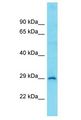 CCDC34 Antibody - CCDC34 antibody Western Blot of COLO205. Antibody dilution: 1 ug/ml.  This image was taken for the unconjugated form of this product. Other forms have not been tested.