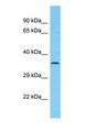 CCDC42B Antibody - Western blot of CCDC42B Antibody with human HeLa Whole Cell lysate.  This image was taken for the unconjugated form of this product. Other forms have not been tested.