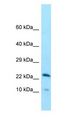 CCDC43 Antibody - CCDC43 antibody Western Blot of Human Small Intestine.  This image was taken for the unconjugated form of this product. Other forms have not been tested.