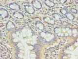 CCDC57 Antibody - Immunohistochemistry of paraffin-embedded human small intestine tissue using antibody at dilution of 1:100.