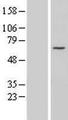 CCDC60 Protein - Western validation with an anti-DDK antibody * L: Control HEK293 lysate R: Over-expression lysate