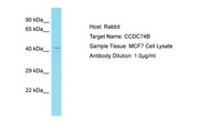 CCDC74B Antibody -  This image was taken for the unconjugated form of this product. Other forms have not been tested.