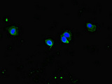 CCDC8 Antibody - Immunofluorescent analysis of HeLa cells diluted at 1:100 and Alexa Fluor 488-congugated AffiniPure Goat Anti-Rabbit IgG(H+L)