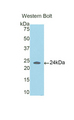 CCDC80 Antibody - Western blot of recombinant CCDC80.  This image was taken for the unconjugated form of this product. Other forms have not been tested.