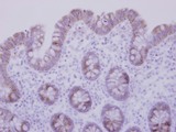 CCDC83 Antibody - IHC of paraffin-embedded Normal Colon using CCDC83 antibody at 1:500 dilution.