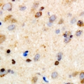 CCDC88A / GIV / Girdin Antibody - Immunohistochemical analysis of Girdin staining in human brain formalin fixed paraffin embedded tissue section. The section was pre-treated using heat mediated antigen retrieval with sodium citrate buffer (pH 6.0). The section was then incubated with the antibody at room temperature and detected using an HRP conjugated compact polymer system. DAB was used as the chromogen. The section was then counterstained with haematoxylin and mounted with DPX.