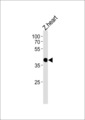 CCDC89 Antibody - DANRE ccdc89 Antibody western blot of zebra fish heart tissue lysates (35 ug/lane). The DANRE ccdc89 antibody detected the DANRE ccdc89 protein (arrow).