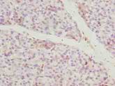 CCDC89 Antibody - Immunohistochemistry of paraffin-embedded human pancreatic tissue using antibody at dilution of 1:100.