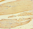 CCDC94 Antibody - Immunohistochemistry of paraffin-embedded human skeletal muscle tissue using CCDC94 Antibody at dilution of 1:100