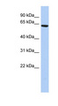 CCDC96 Antibody - CCDC96 antibody Western blot of HepG2 cell lysate. This image was taken for the unconjugated form of this product. Other forms have not been tested.