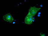 CCK4 / PTK7 Antibody - Anti-PTK7 mouse monoclonal antibody immunofluorescent staining of COS7 cells transiently transfected by pCMV6-ENTRY PTK7.