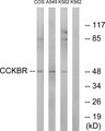 CCKBR / Cckb Antibody - Western blot analysis of lysates from A549, COS7, and K562 cells, using CCKBR Antibody. The lane on the right is blocked with the synthesized peptide.