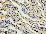 CCL11 / Eotaxin Antibody - Immunohistochemistry of paraffin-embedded human lung tissue using antibody at 1:100 dilution.